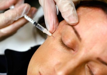 10 cosas que siempre quisiste saber del bótox y no te atreviste a preguntar