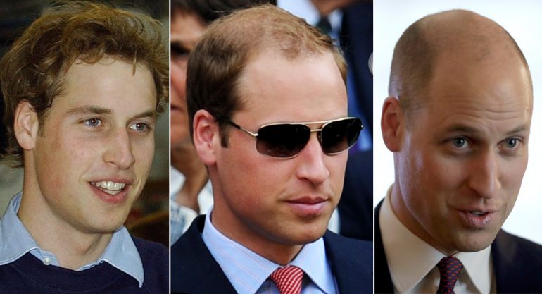 El nuevo look del príncipe William