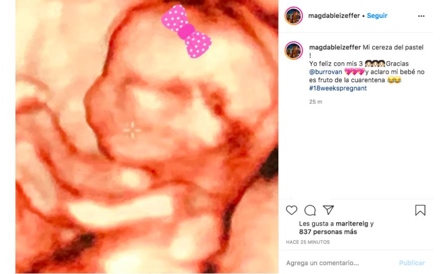 Magda Bleizeffer está embarazada del Burro van rankin