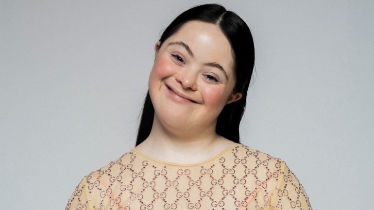 modelo síndrome de down gucci