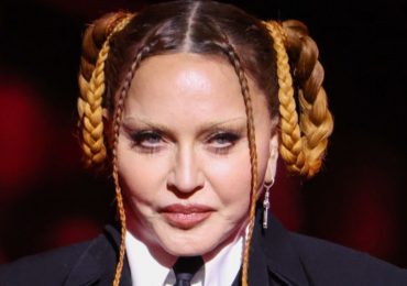 madonna grammys 2023 que le paso en la cara