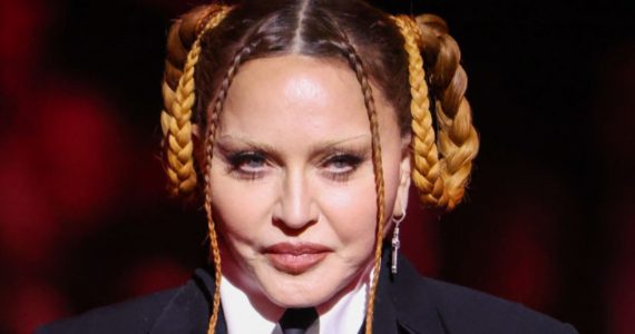 madonna grammys 2023 que le paso en la cara