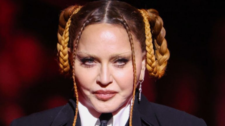 madonna grammys 2023 que le paso en la cara